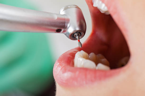 Best Walk-In Emergency Dental Services in Lander, WY